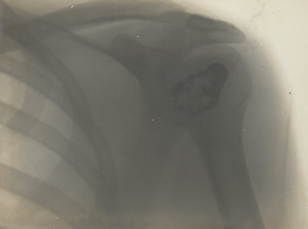 Photo from page 02 of album WWI Photograph Album - Gallipoli, Egypt, Western Front and England.