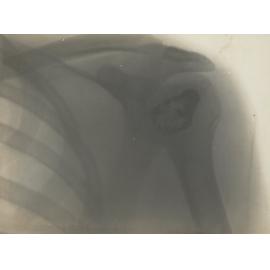 Photo from page 02 of album WWI Photograph Album - Gallipoli, Egypt, Western Front and England.